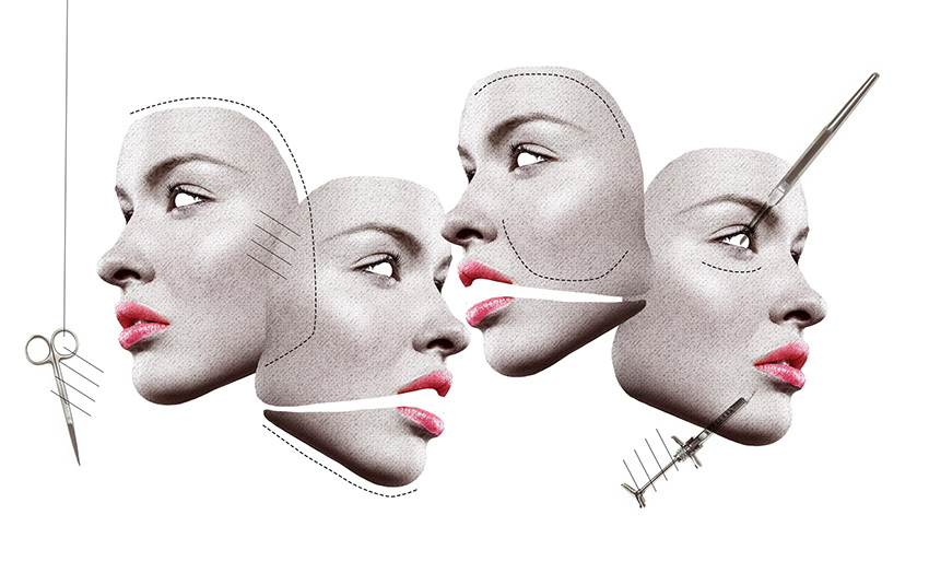 cirurgia plastica rosto interna